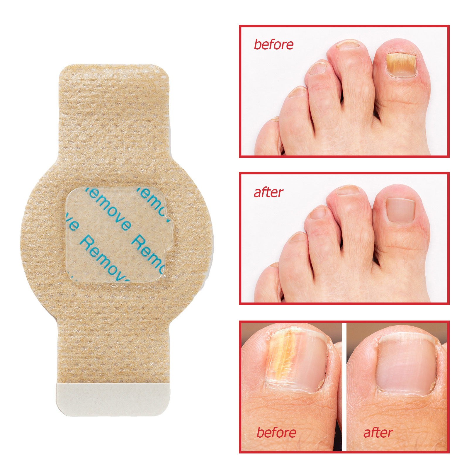NailRevive™ – Des ongles sains retrouvés