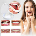 Veneers Snap on Smile (Supérieur & Inférieur)
