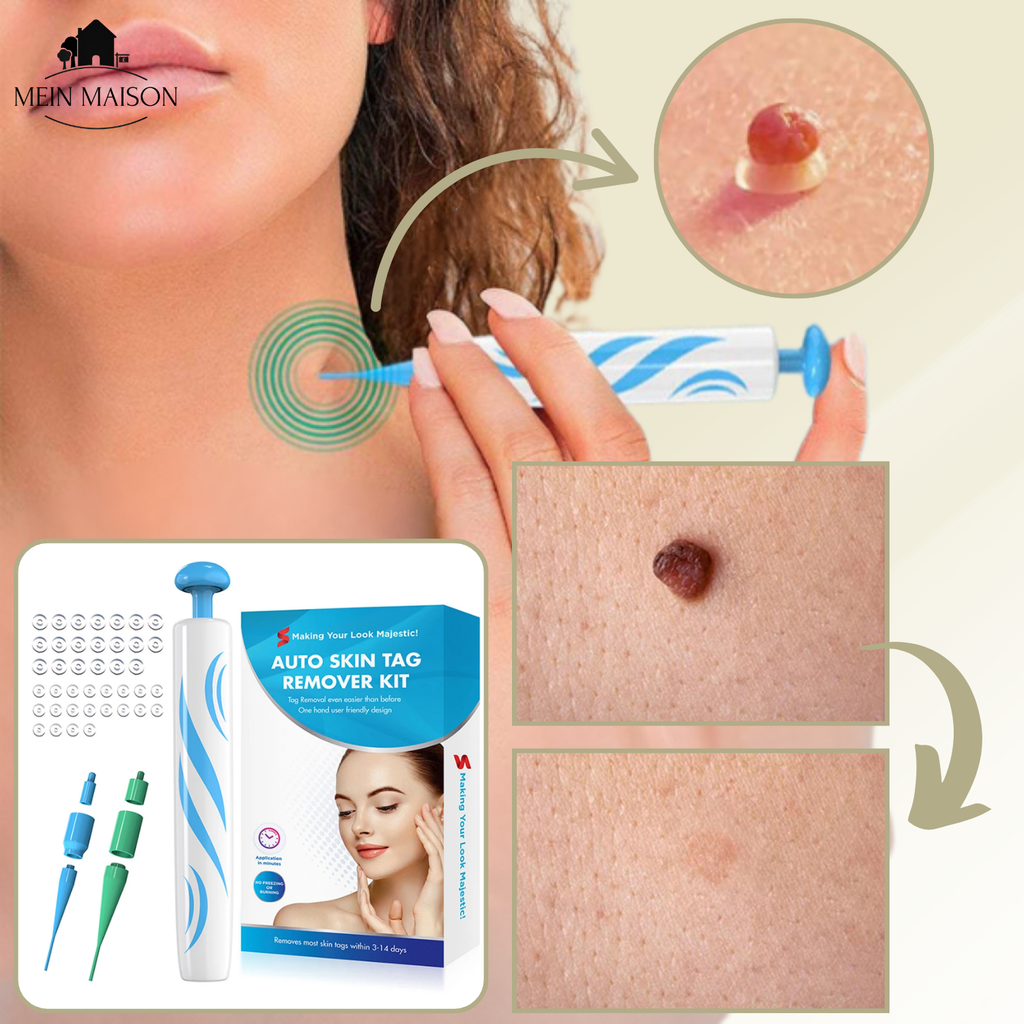 DermaLinx Enlève Verrues | Élimination Indolore des Verrues et Nés | Pour la Maison | Sans Chirurgie