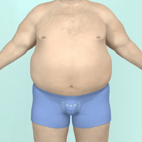 AlphaShape | Favorise la perte de tissu adipeux | Ressentez-vous rapidement en forme !