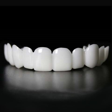 Veneers Snap on Smile (Supérieur & Inférieur)