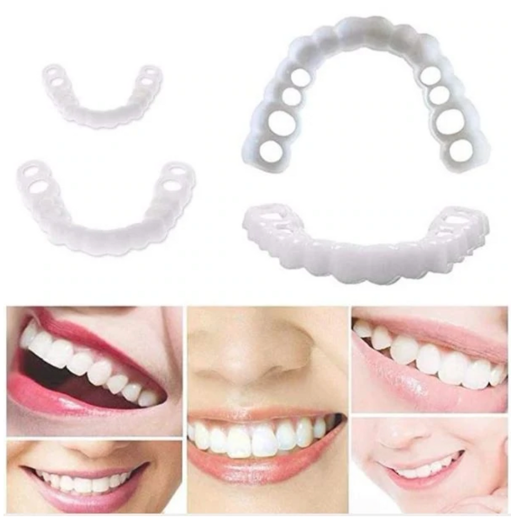HappySmile Facetset | Facettes supérieures et inférieures réutilisables pour un sourire éclatant