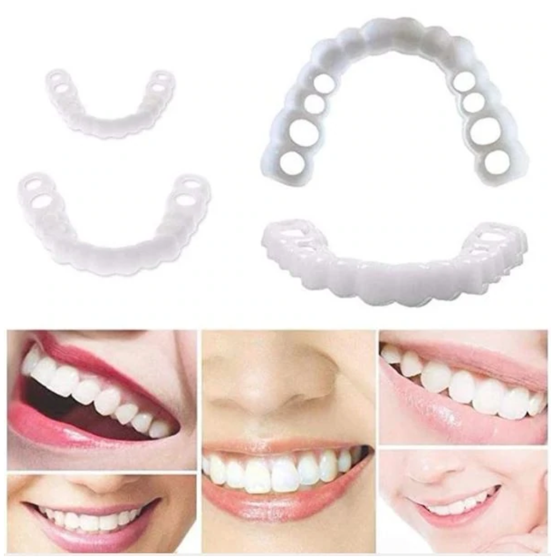 HappySmile Facetset | Facettes supérieures et inférieures réutilisables pour un sourire éclatant