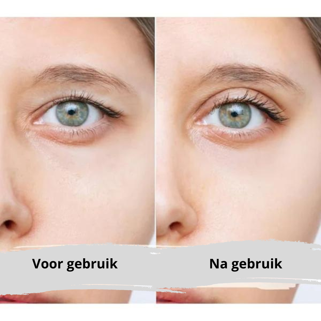 EyePerfection | Bande de Paupières Double pour Paupières Tombantes | Unisexe