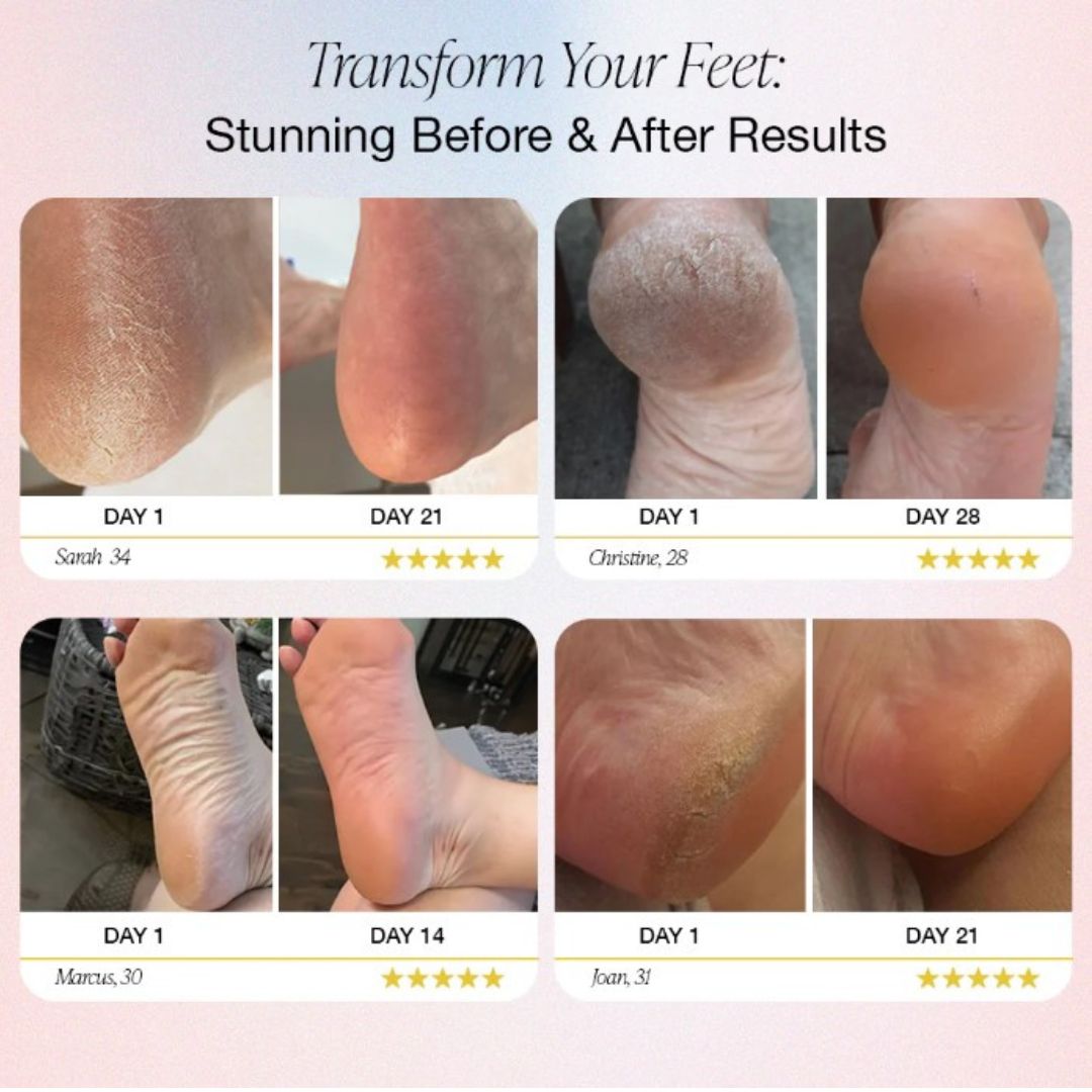 SmootherFeet Outil de Pédicure Électrique | Soin professionnel à portée de main