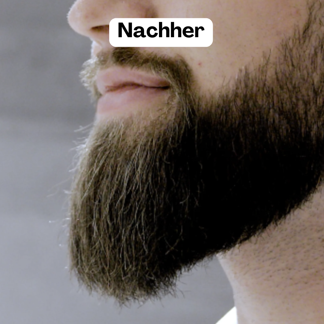BeardMaster | Stylo à Barbe Ion Négatif Sans Fil