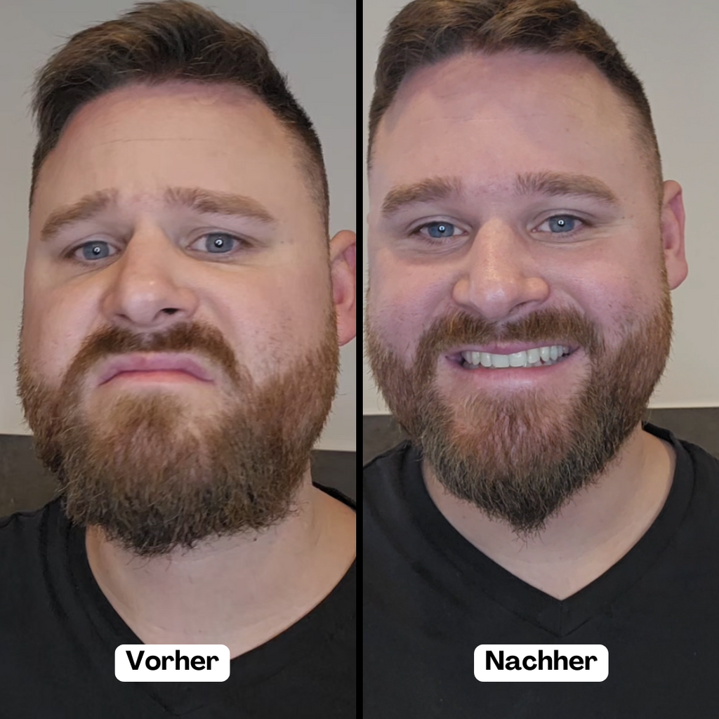 BeardMaster | Stylo à Barbe Ion Négatif Sans Fil