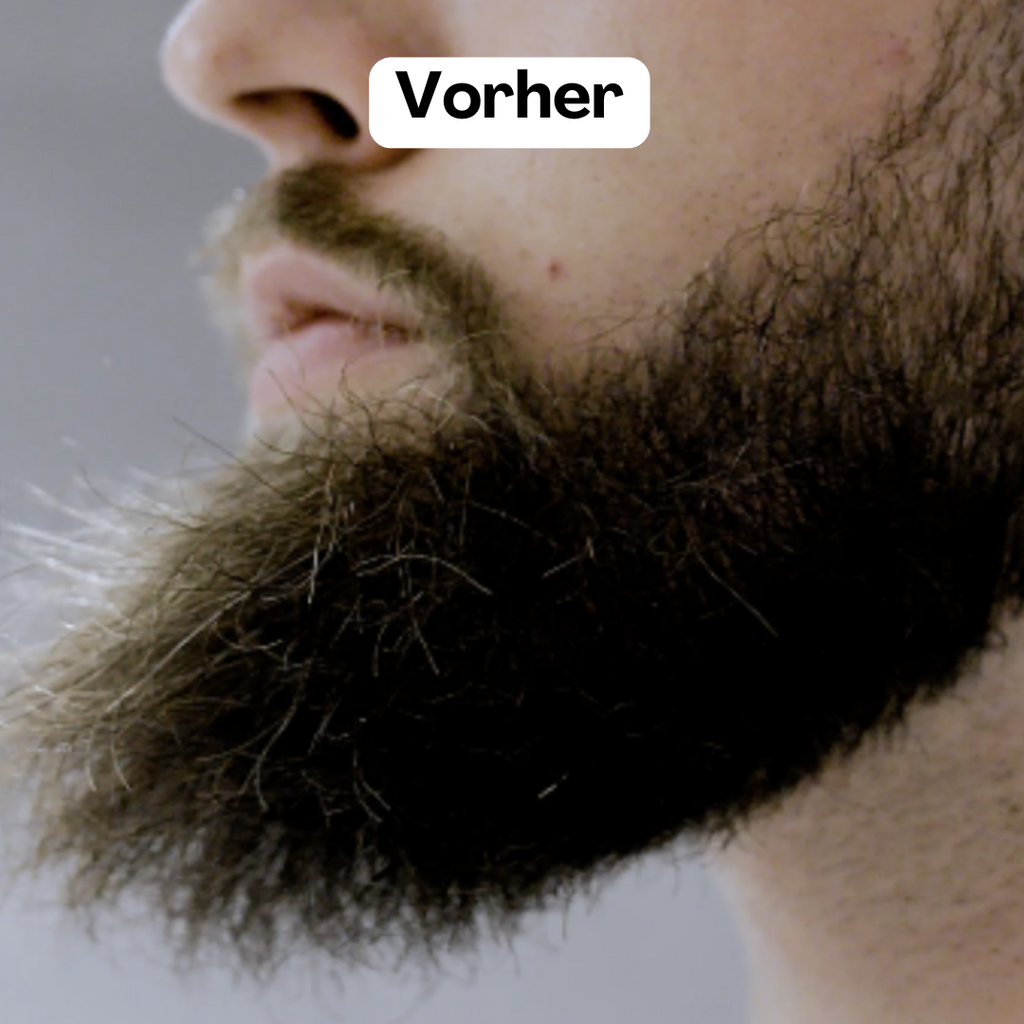 BeardMaster | Stylo à Barbe Ion Négatif Sans Fil