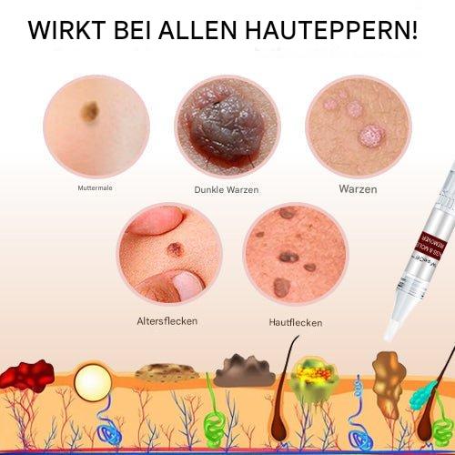 WartOff Éliminateur de Taches de Peau Sans Douleur Formule Naturelle 1 Plus 1 Gratuit