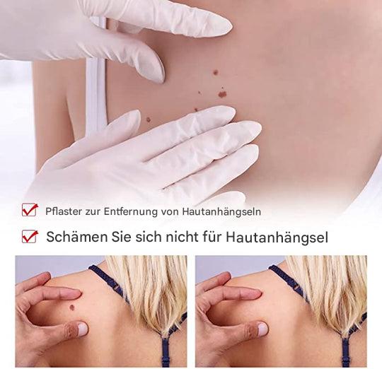 WartOff Éliminateur de Taches de Peau Sans Douleur Formule Naturelle 1 Plus 1 Gratuit
