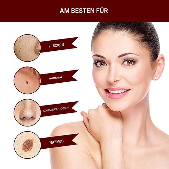 WartOff Éliminateur de Taches de Peau Sans Douleur Formule Naturelle 1 Plus 1 Gratuit