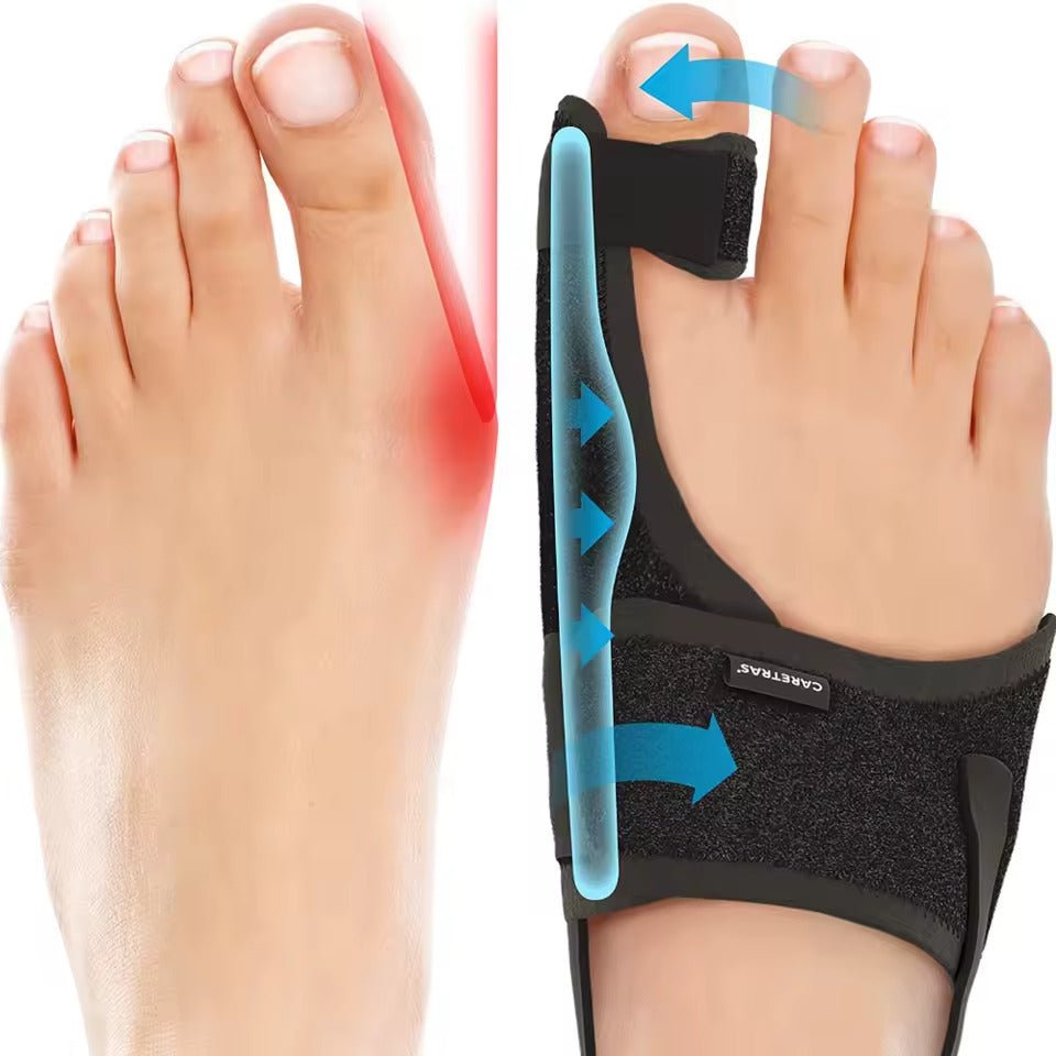 Attelle de Nuit Hallux Valgus - Ergonomique et Réglable Confort