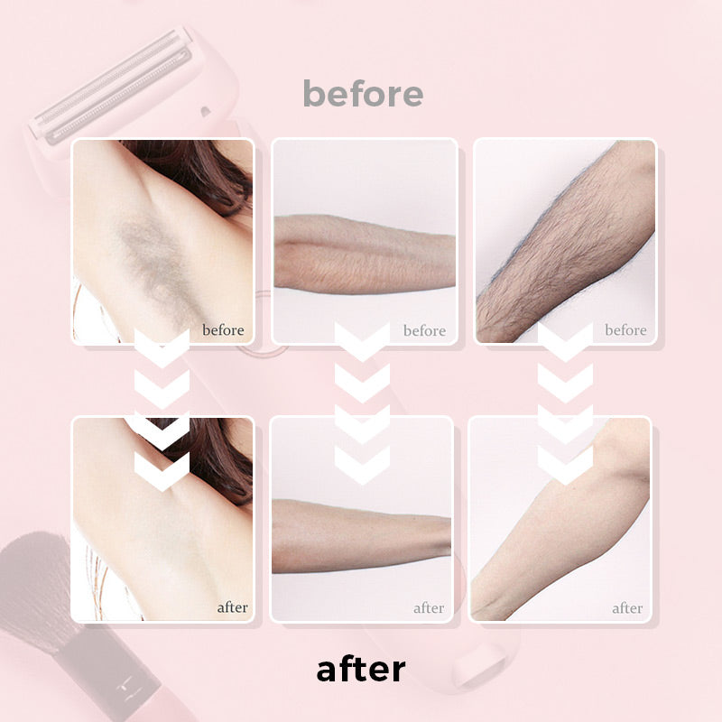 SilkSmooth Rasoir Électrique | Épilation sans effort avec une touche soyeuse