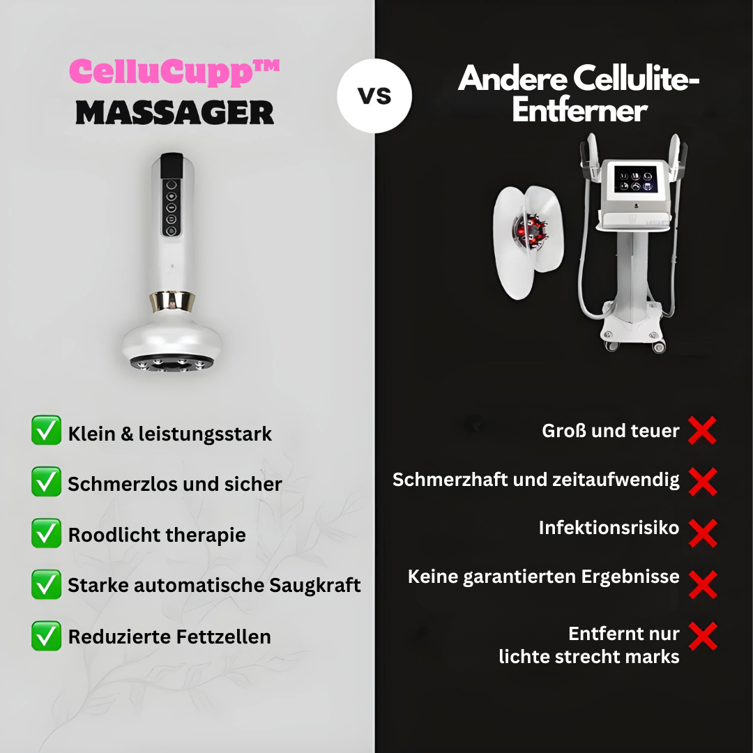 Appareil de Cupping Anti-Cellulite – SlimCupp