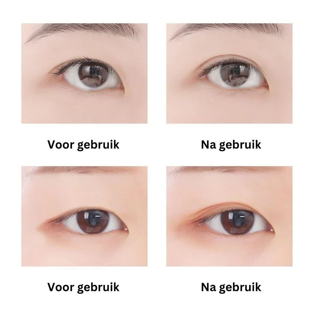 EyePerfection | Bande de Paupières Double pour Paupières Tombantes | Unisexe