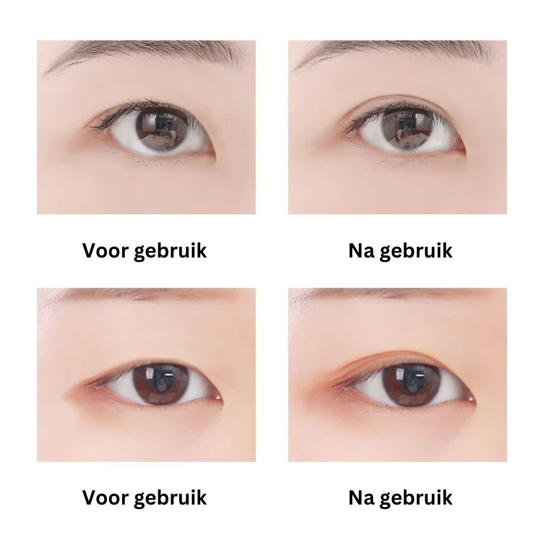 EyePerfection | Bande de Paupières Double pour Paupières Tombantes | Unisexe