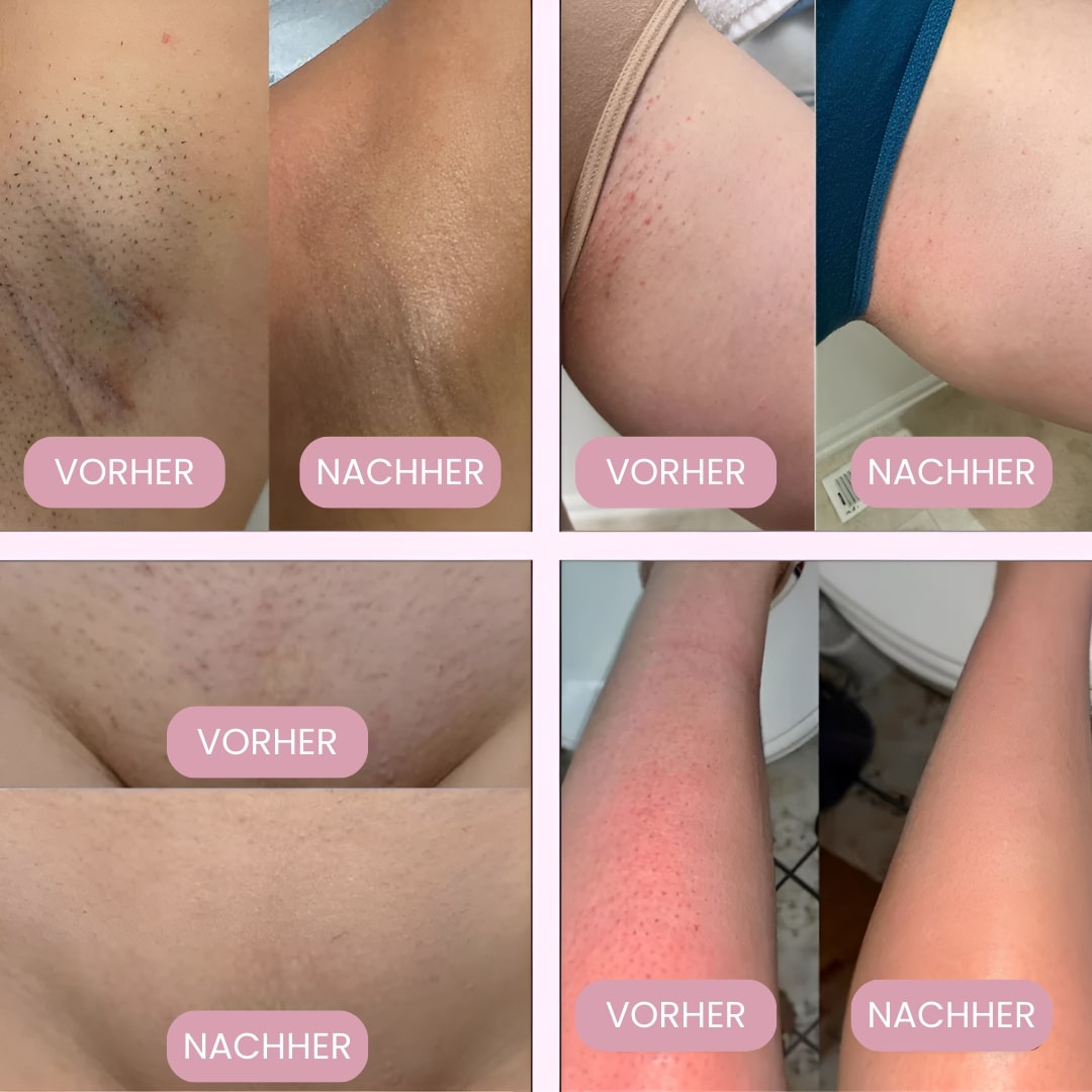 Rasoir intime pour femmes | Rasoir électrique pour la zone intime | Tondeuse bikini | Femora
