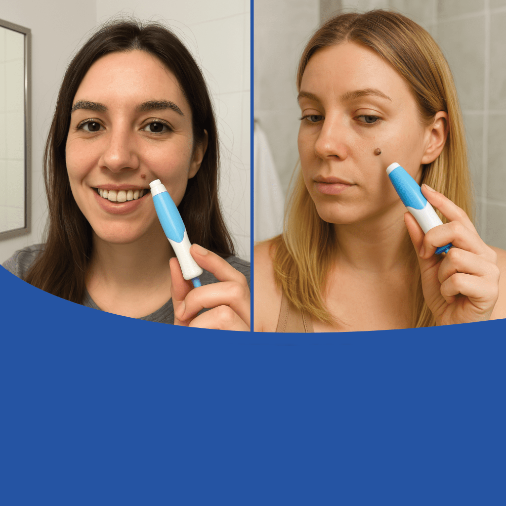 LuxuraCare Professionnel Éliminateur de Verrues | Solution efficace pour l'élimination douce des verrues filiformes