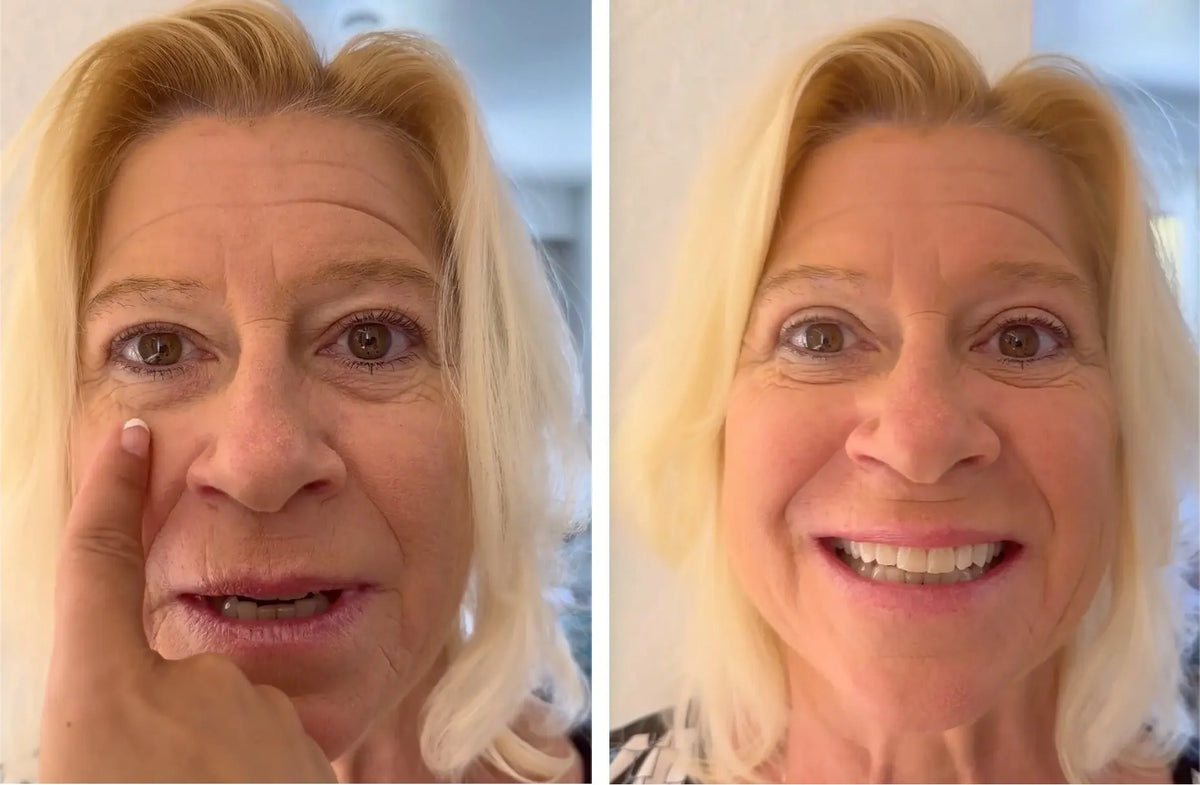 EyePerfection | Bande de Paupières Double pour Paupières Tombantes | Unisexe