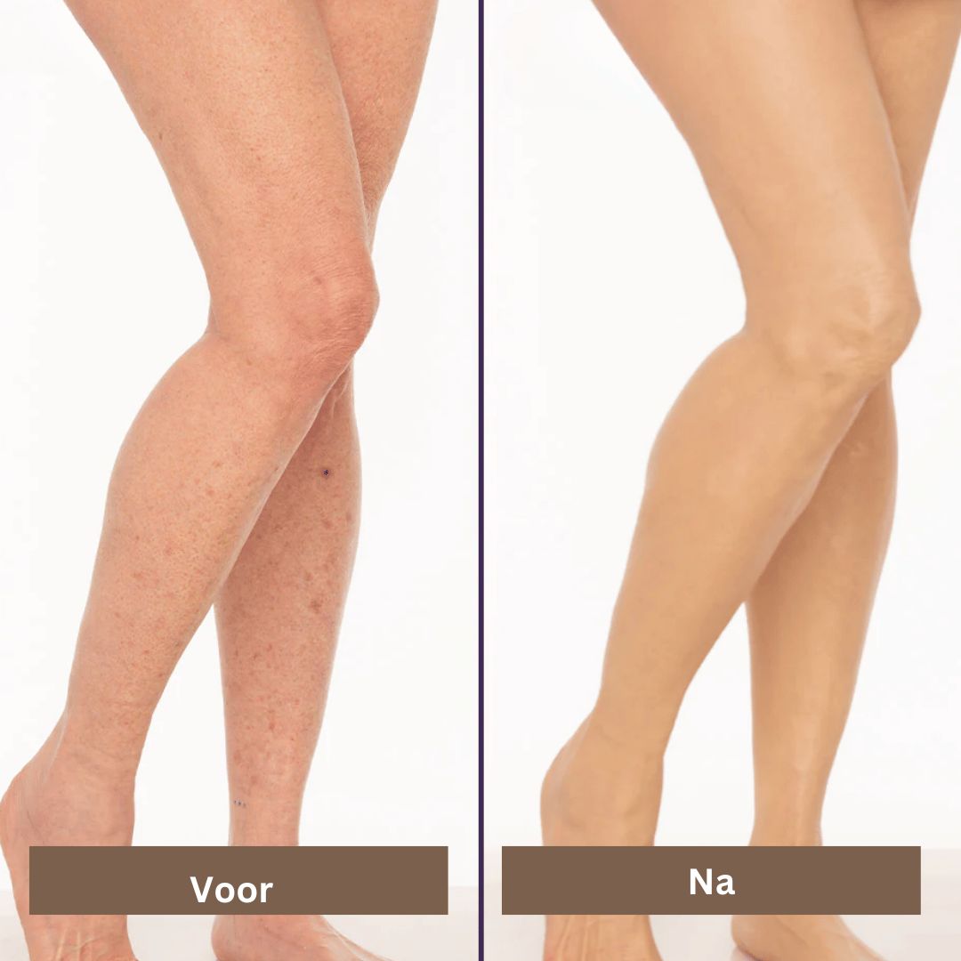 SmoothTone soins de la peau | Pour couvrir les cicatrices, les veines, l'acné et les taches de soleil