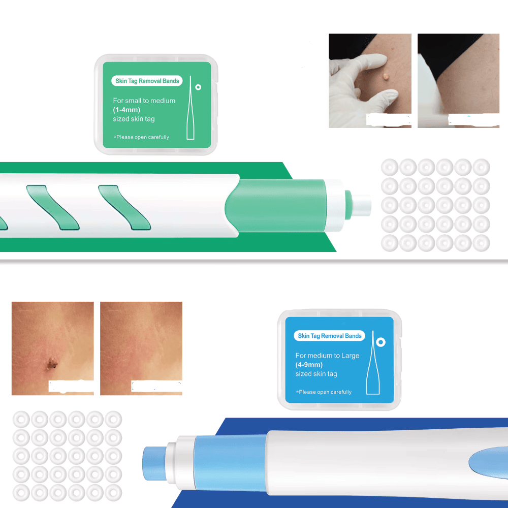 LuxuraCare Professionnel Éliminateur de Verrues | Solution efficace pour l'élimination douce des verrues filiformes
